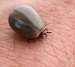 A tick bite on the skin of a person.