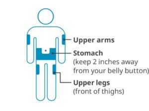 Diagram of upper arms, stomach, and legs.